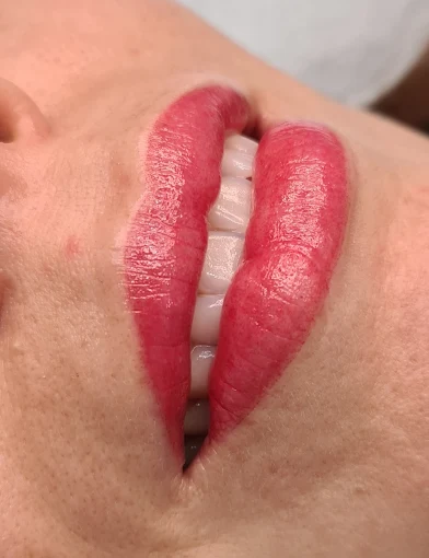 Resultado de micropigmentação labial, caso 1
