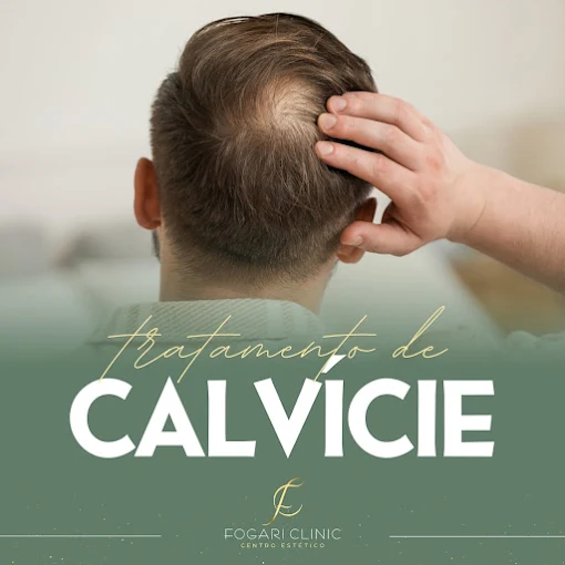 Tratamento para Calvície